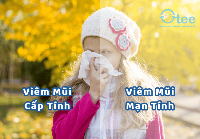 phân biệt viêm mũi cấp tính và viêm mũi mạn tính